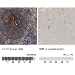 SIT1 Antibody, Novus Biologicals 25 &mu;L, Unlabeled:Antibodies, Polyclonal